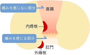 ジオン注射(ALTA療法）とは？